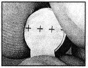 Adhesive tab activates the battery